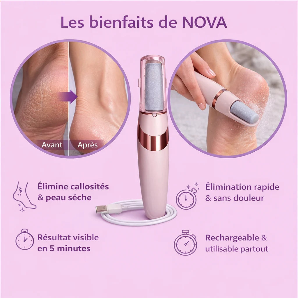 Râpe Électrique pour Pieds Rechargeable USB - PediSmooth
