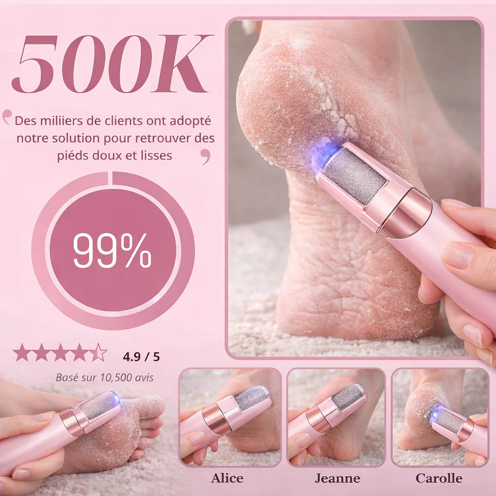 Râpe Électrique pour Pieds Rechargeable USB - PediSmooth